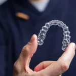 Aparat Invisalign Lublin