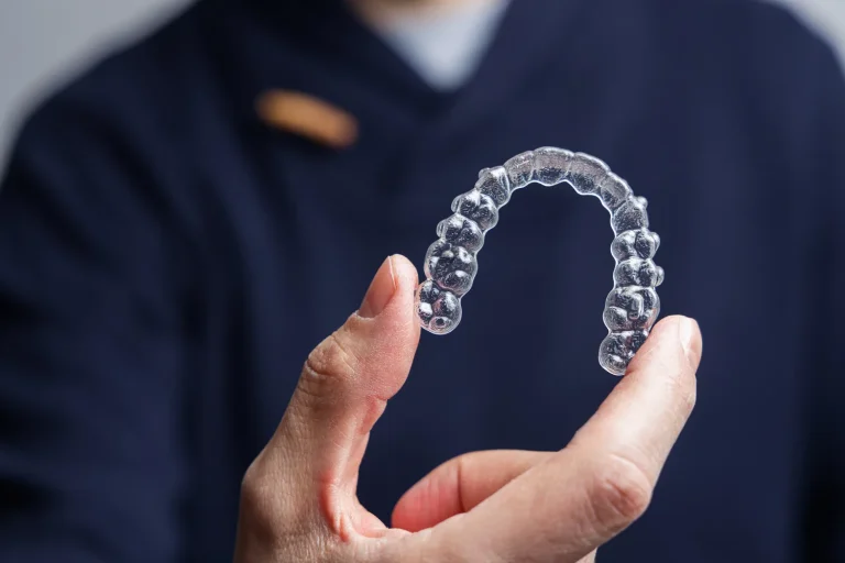 nakladki-invisalign-warszawa-1