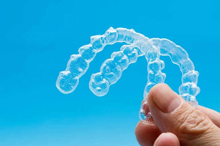 aparat-nakladkowy-invisalign-warszawa-1